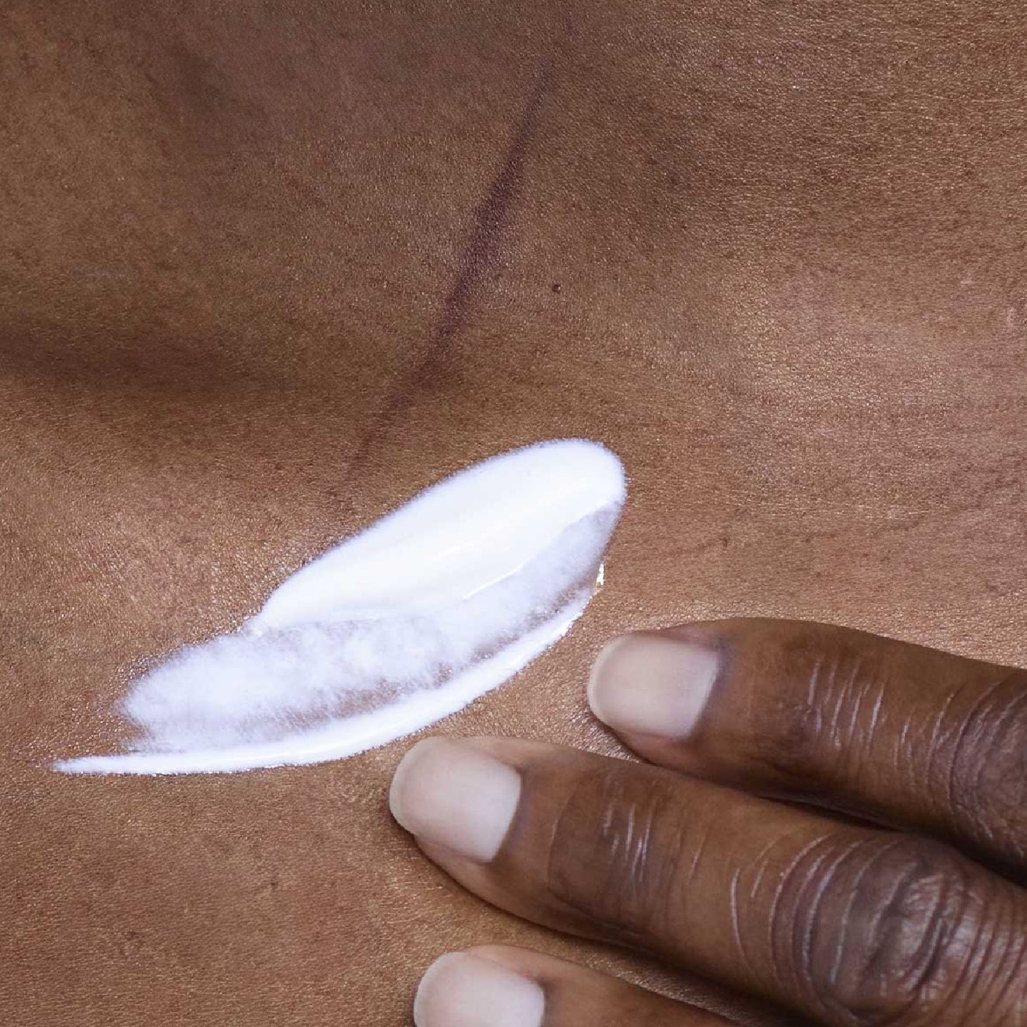 La Roche Posay Cicaplast B5+ Bálsamo Ultra Reparador 100 ml