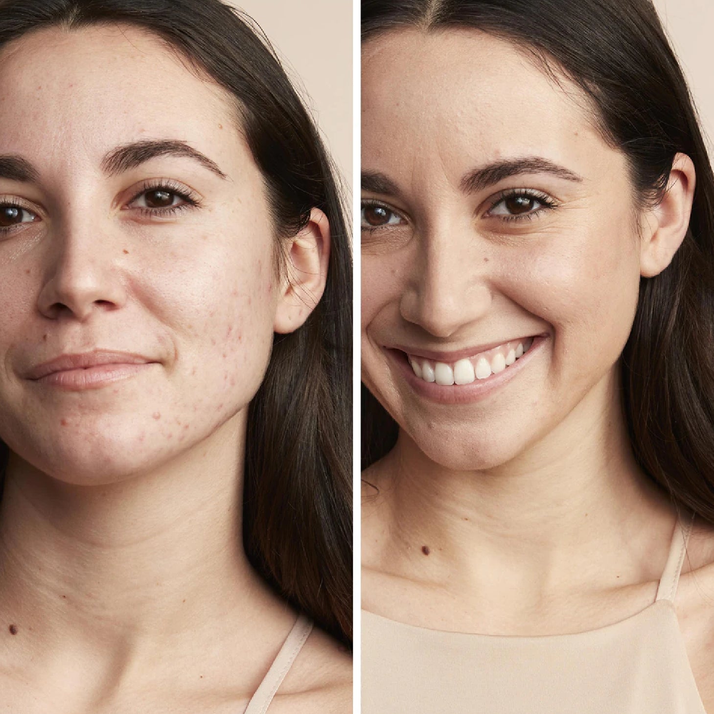 Avène Couvrance Creme Compacto Corretor de Tez 1.3 Mel 8,5g