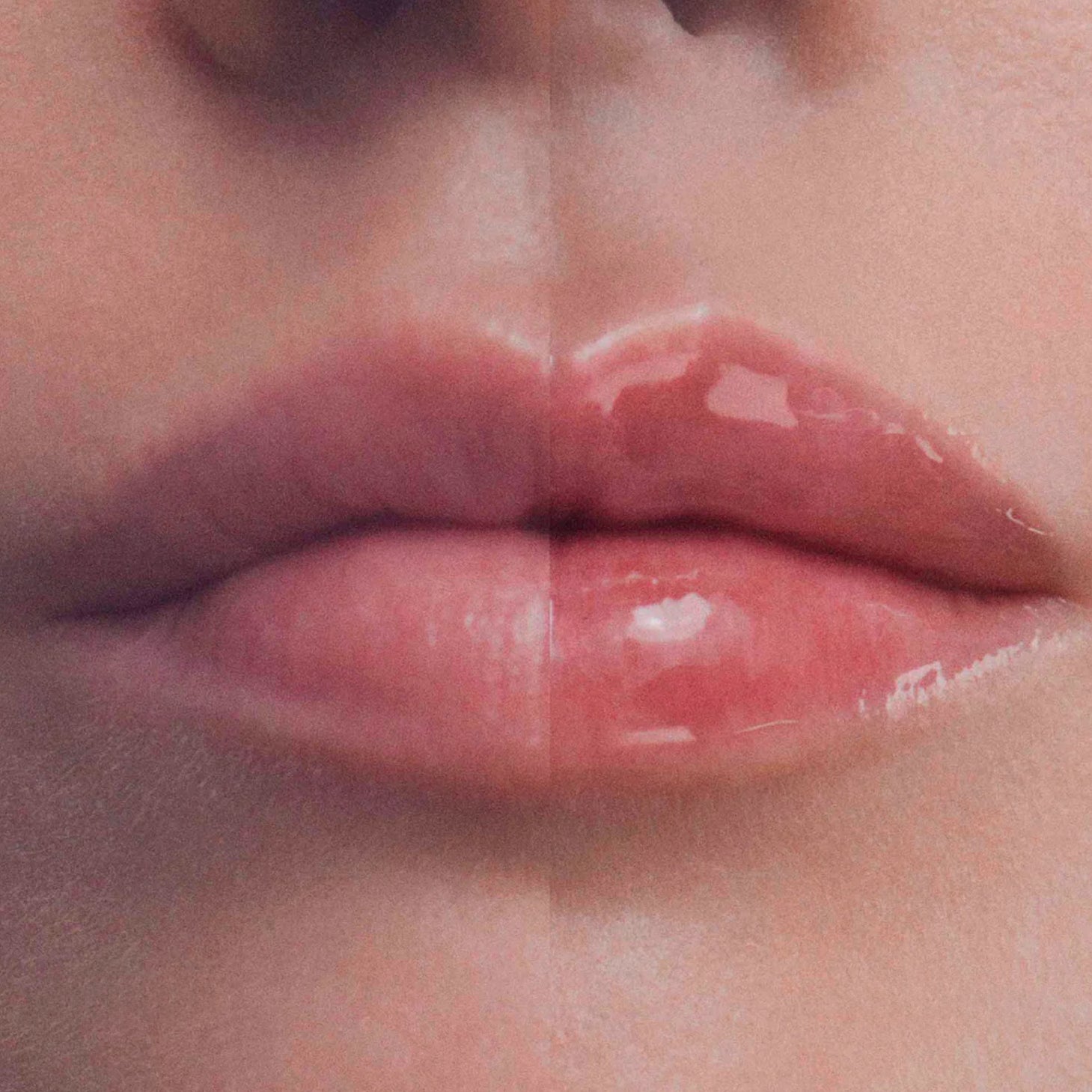 Bálsamo labial Filorga Hyalu-Filler 4 g