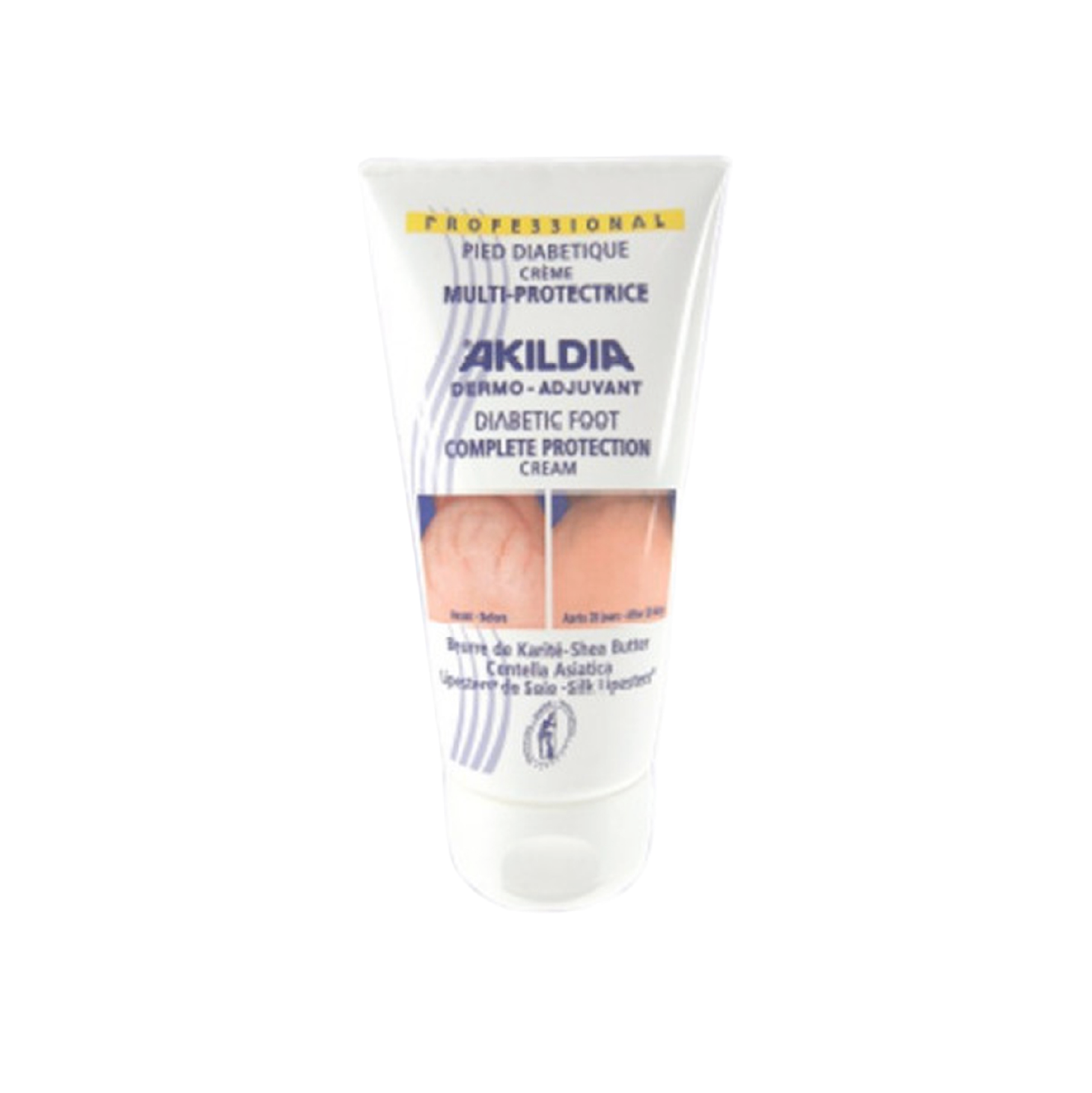 Akildia Creme Pé Diabético 150ml