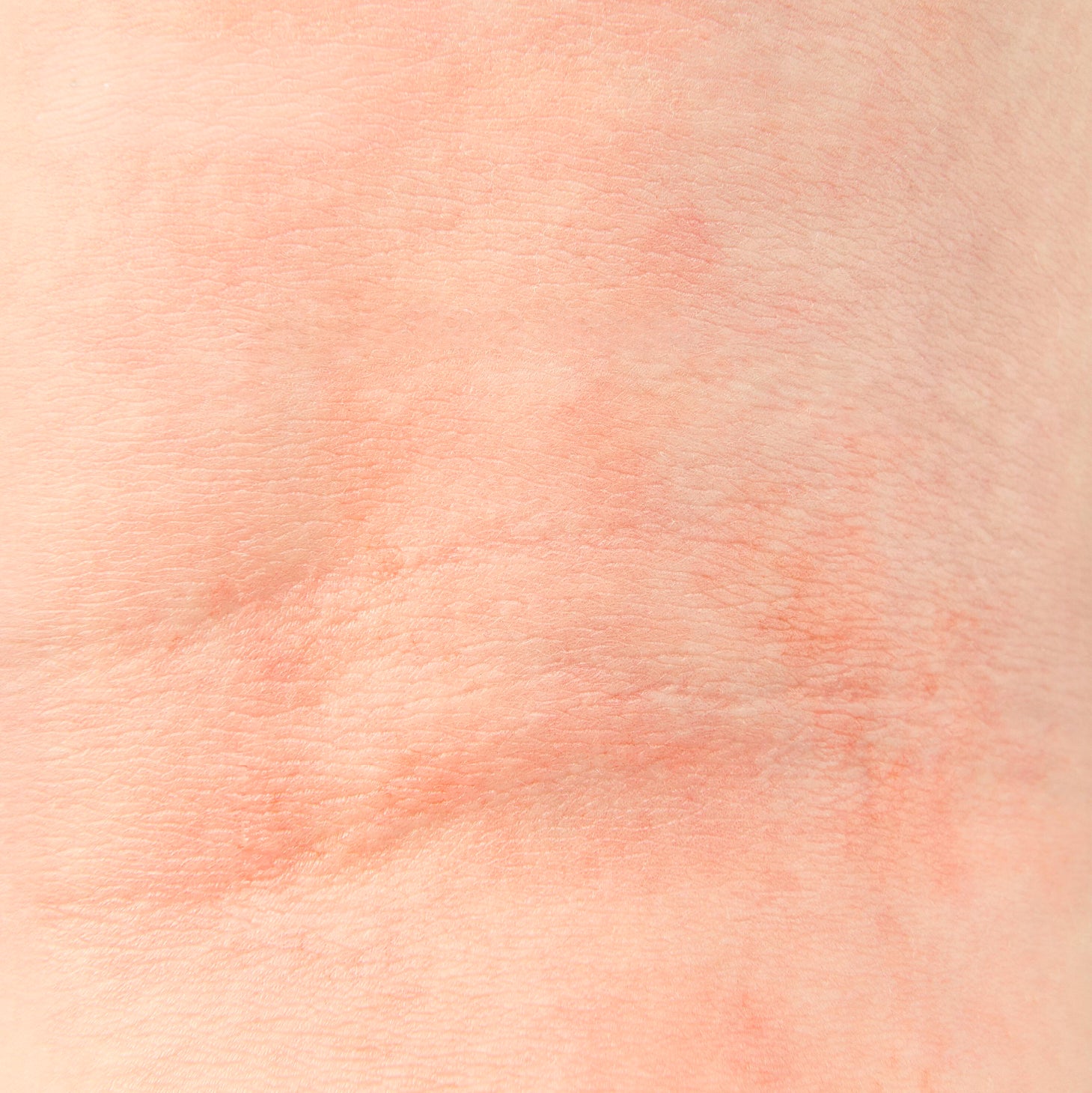 Dexeryl Creme Emoliente 50g